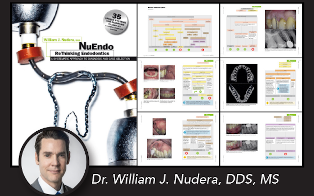 Think Like an Endodontist and “ReThink” Your Approach to Endodontics!