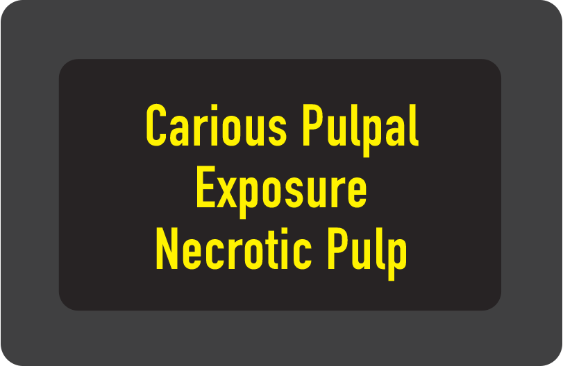 Carious Pulpal Exposure with Necrotic Pulp