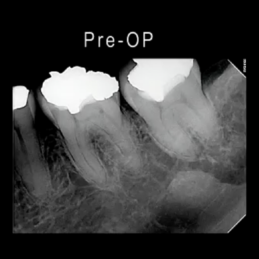 Enhance Treatment Predictability