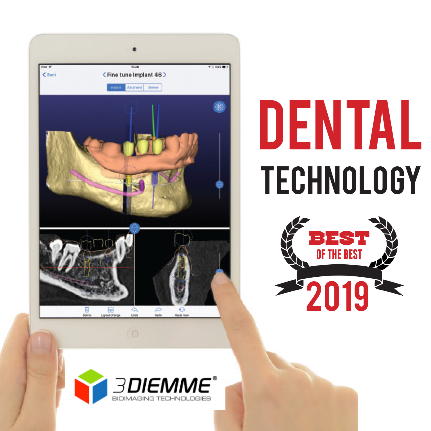 Best Dental Technology: RealGUIDE 5.0 From 3DIEMME - The New Dentist