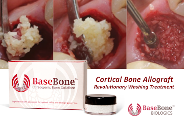 BaseBone Cortical Bone Allograft