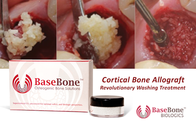 BaseBone Cortical Bone Allograft