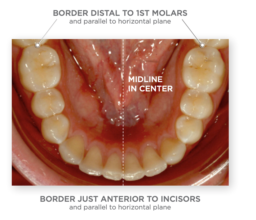 Guide to Orthodontics Photography