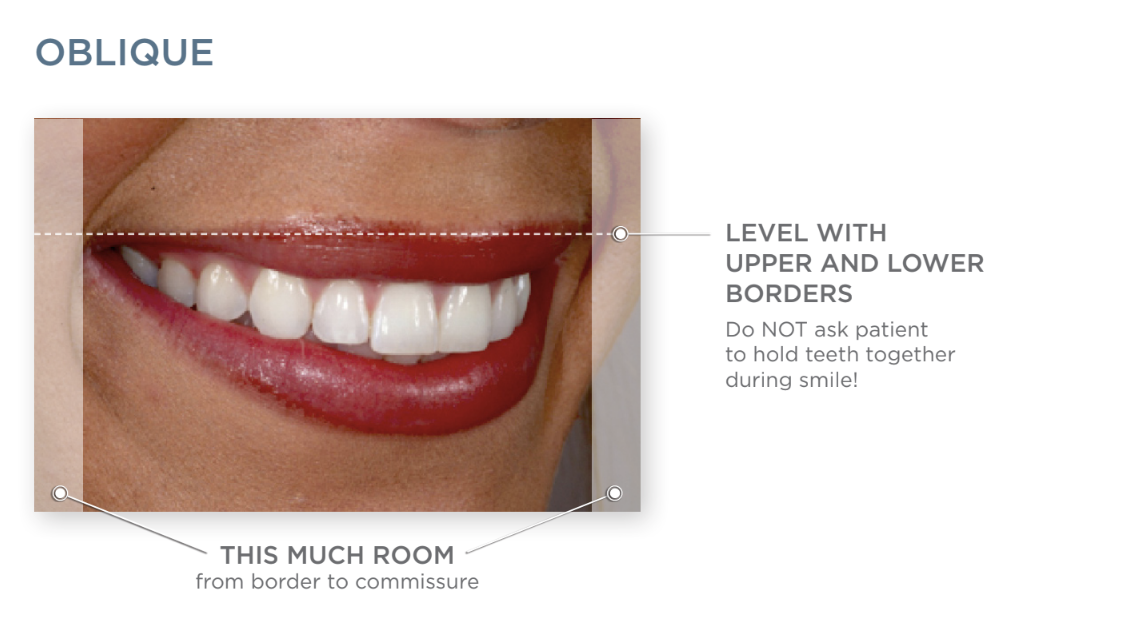 Guide to Orthodontics Photography