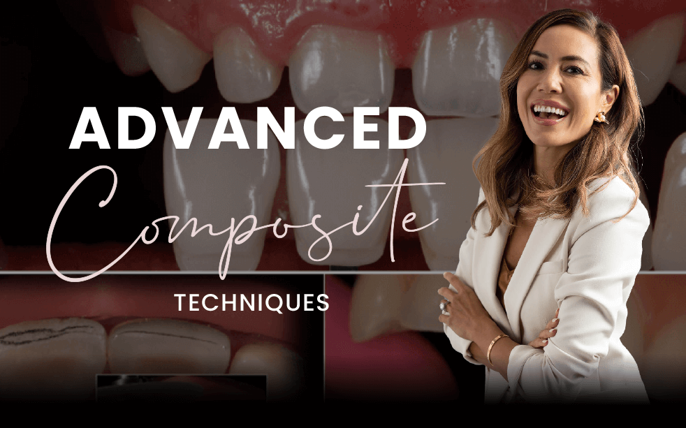 Advanced Techniques in Composite Dentistry