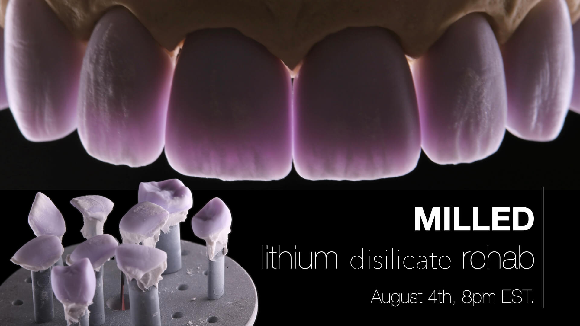 Milled: Lithium Disilicate Rehab