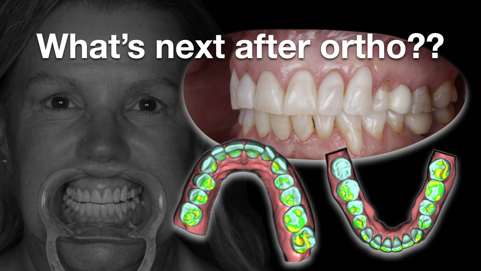What’s Next After Ortho?