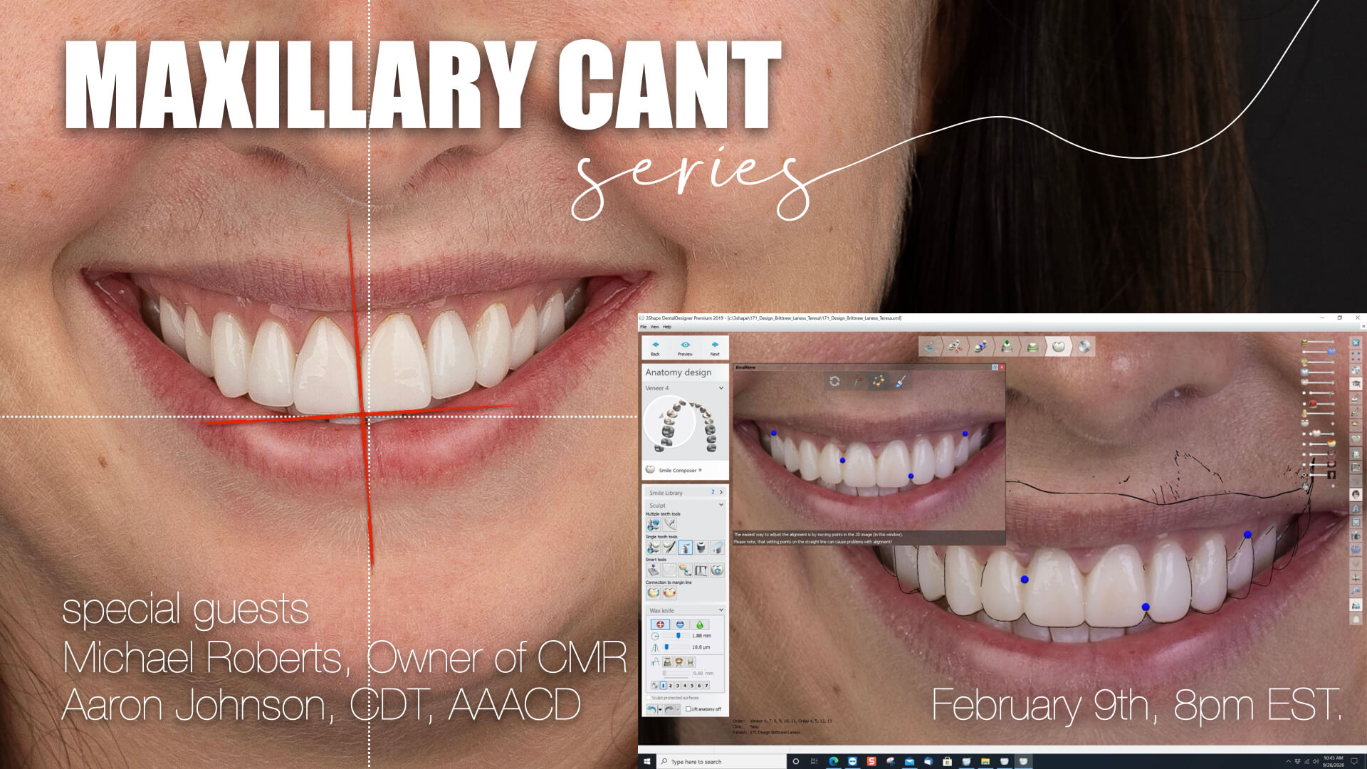 February Case Discussion: Maxillary Cant Series: Kicking off the year with a powerful case discussion