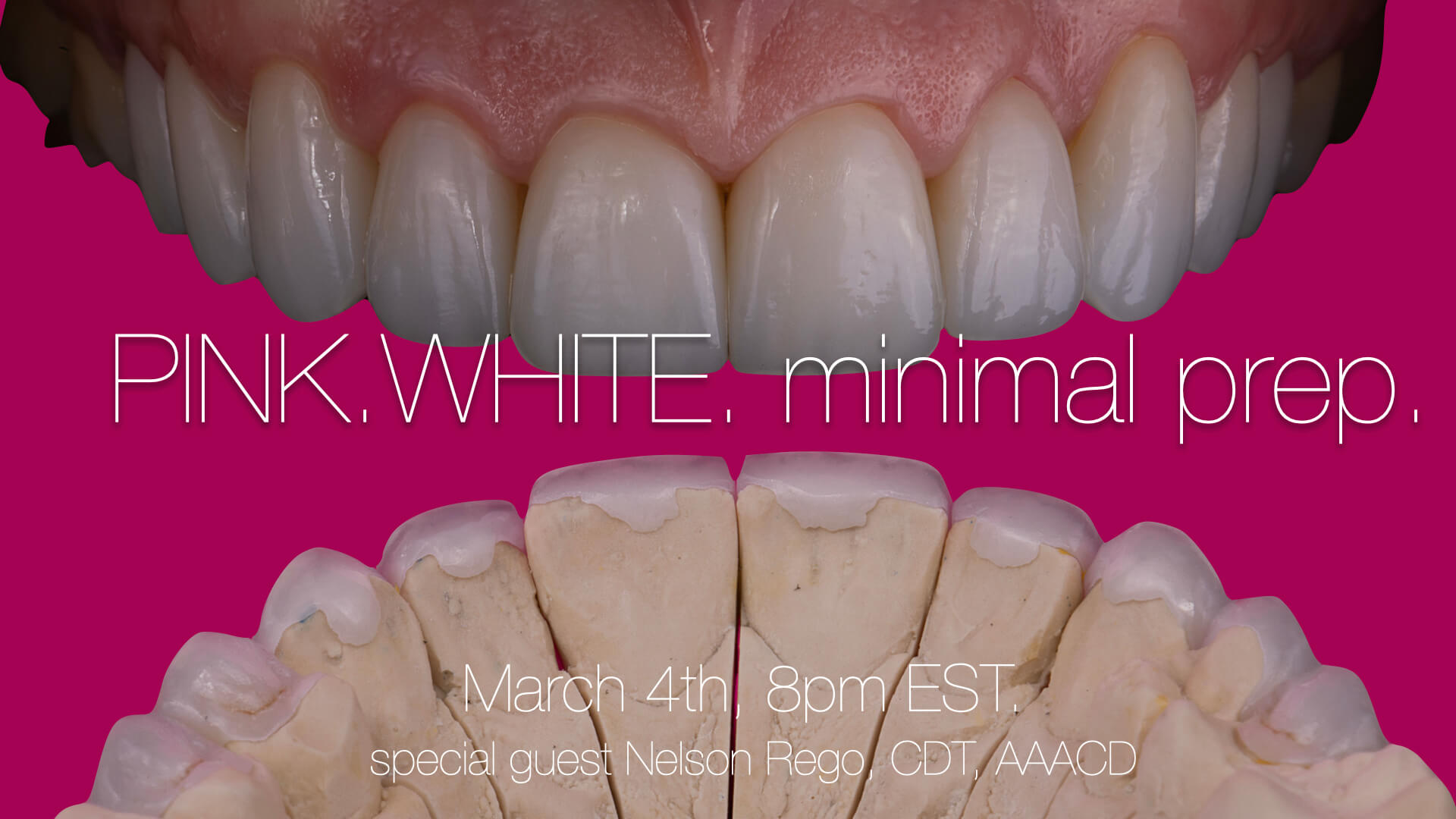 Pink. White. Minimal Prep.