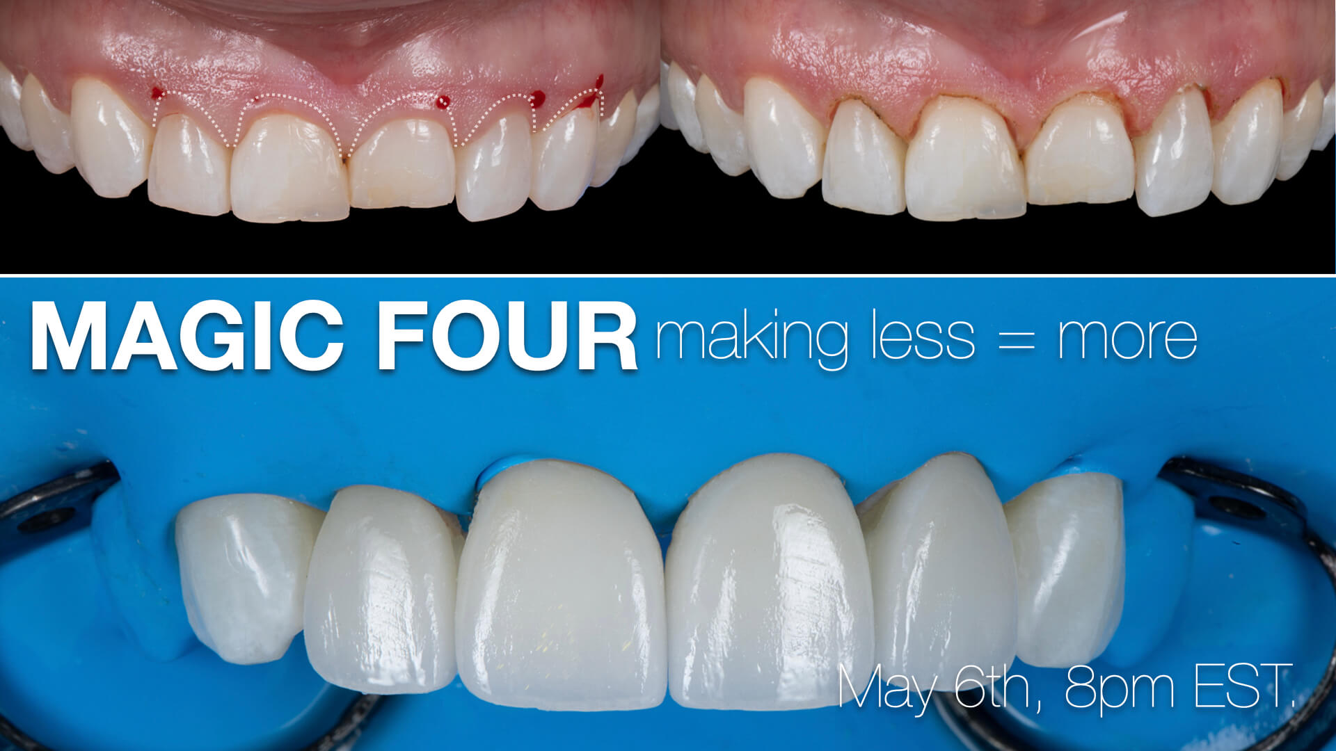Magic Four: Making Less = More