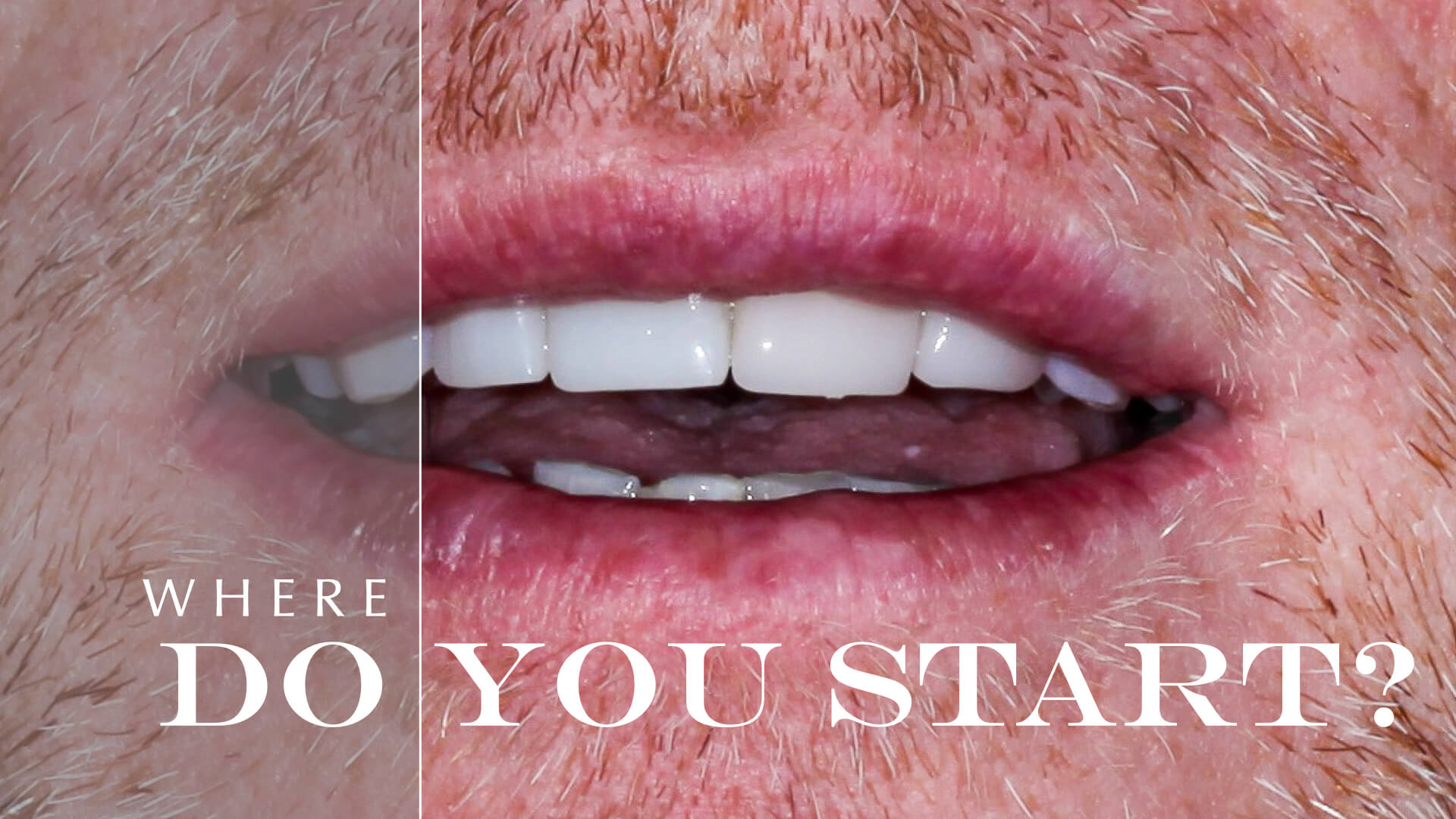 Comprehensive Dental Evaluation: Where Do We Put the Teeth Within the Face?