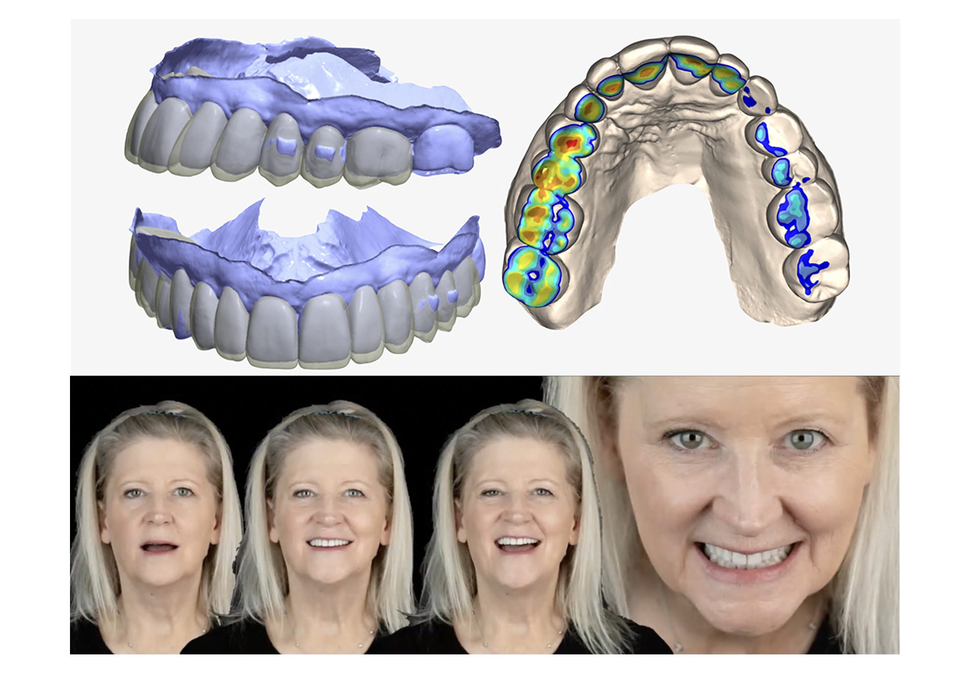 Prioritizing Pre-Restorative Orthodontics for Functional Excellence