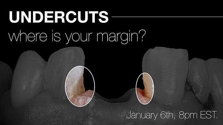 Undercuts: Where’s Your Margin?
