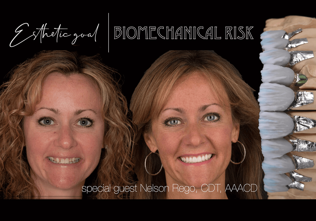 Harmony in Esthetics: Choosing the Right Materials