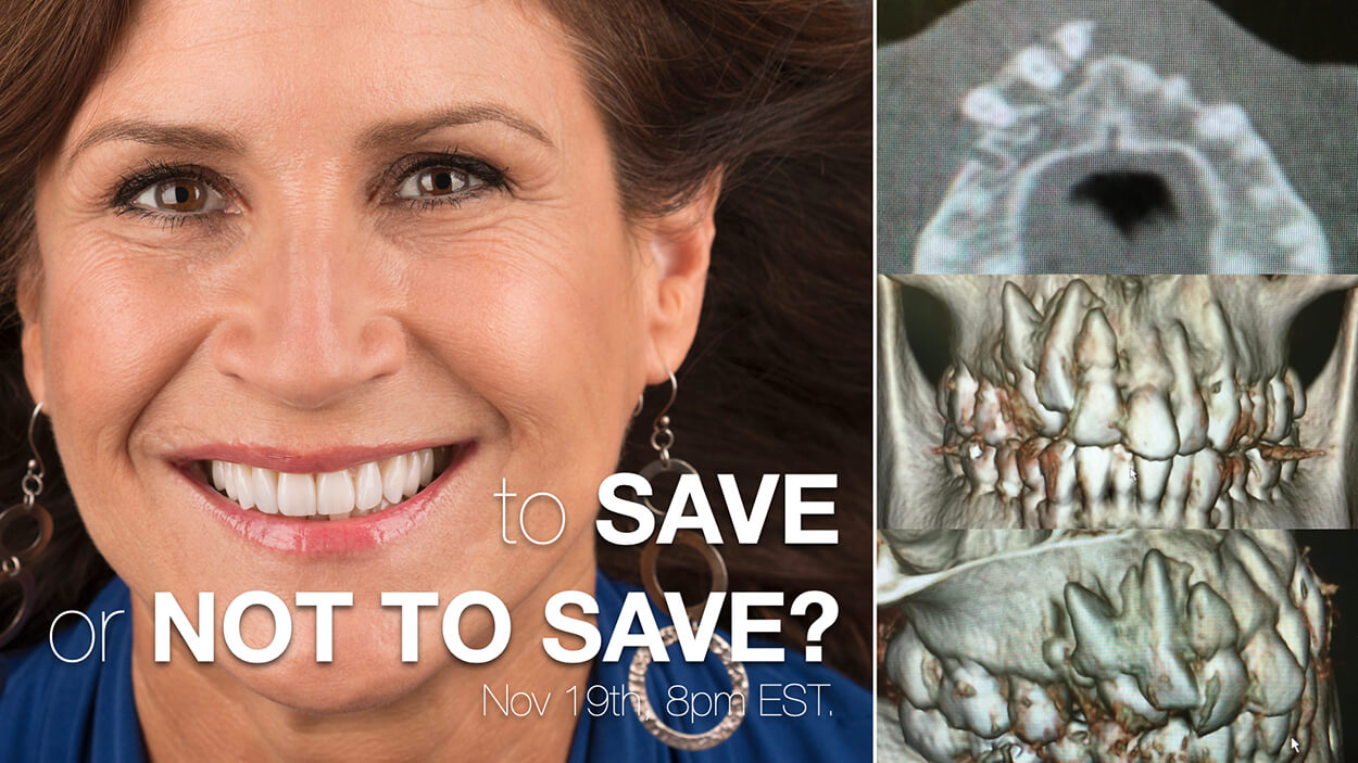 To Save or Not to Save?