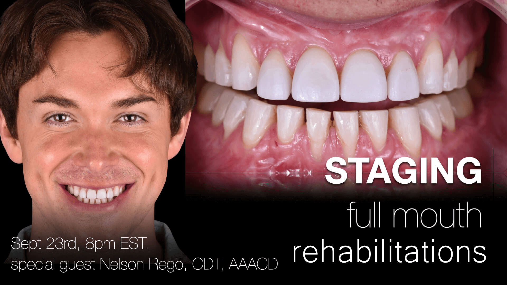 Staging Full Mouth Rehabilitations