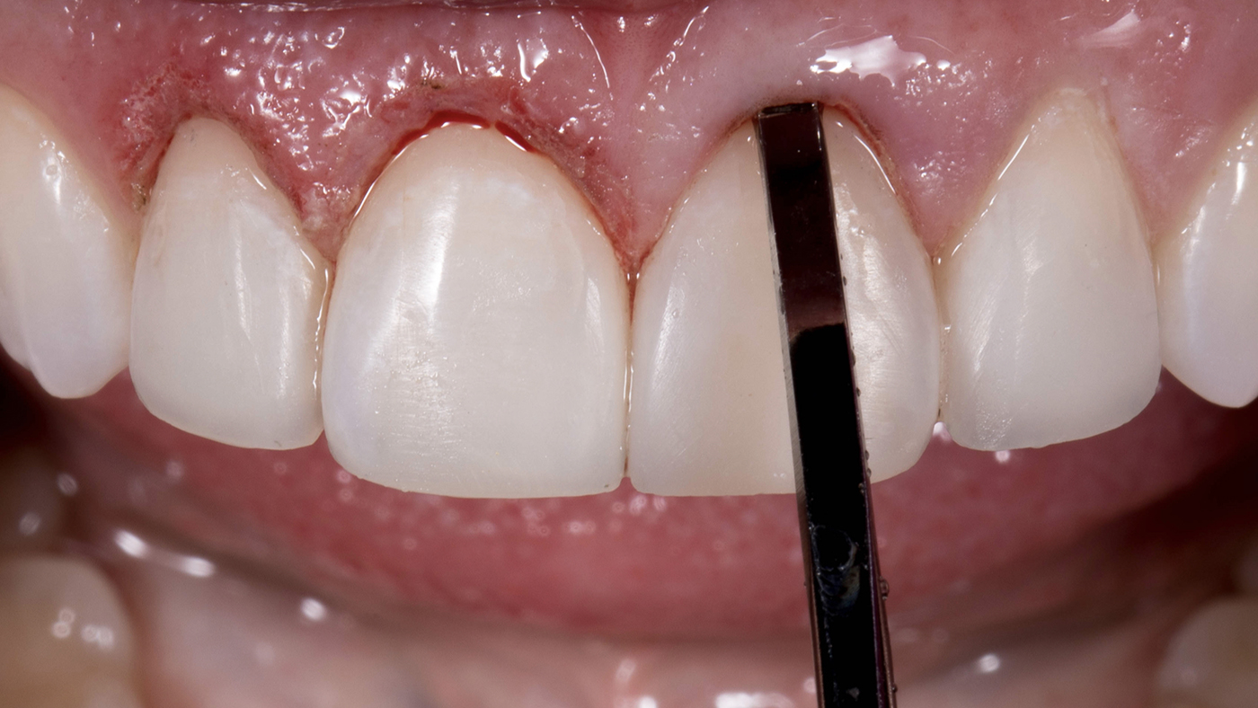 A Predictable Procedure Guide