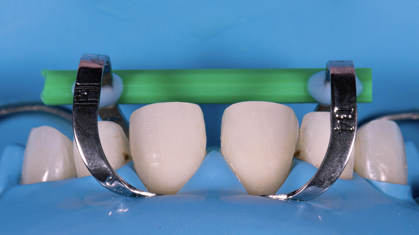 Minimal Orthodontics