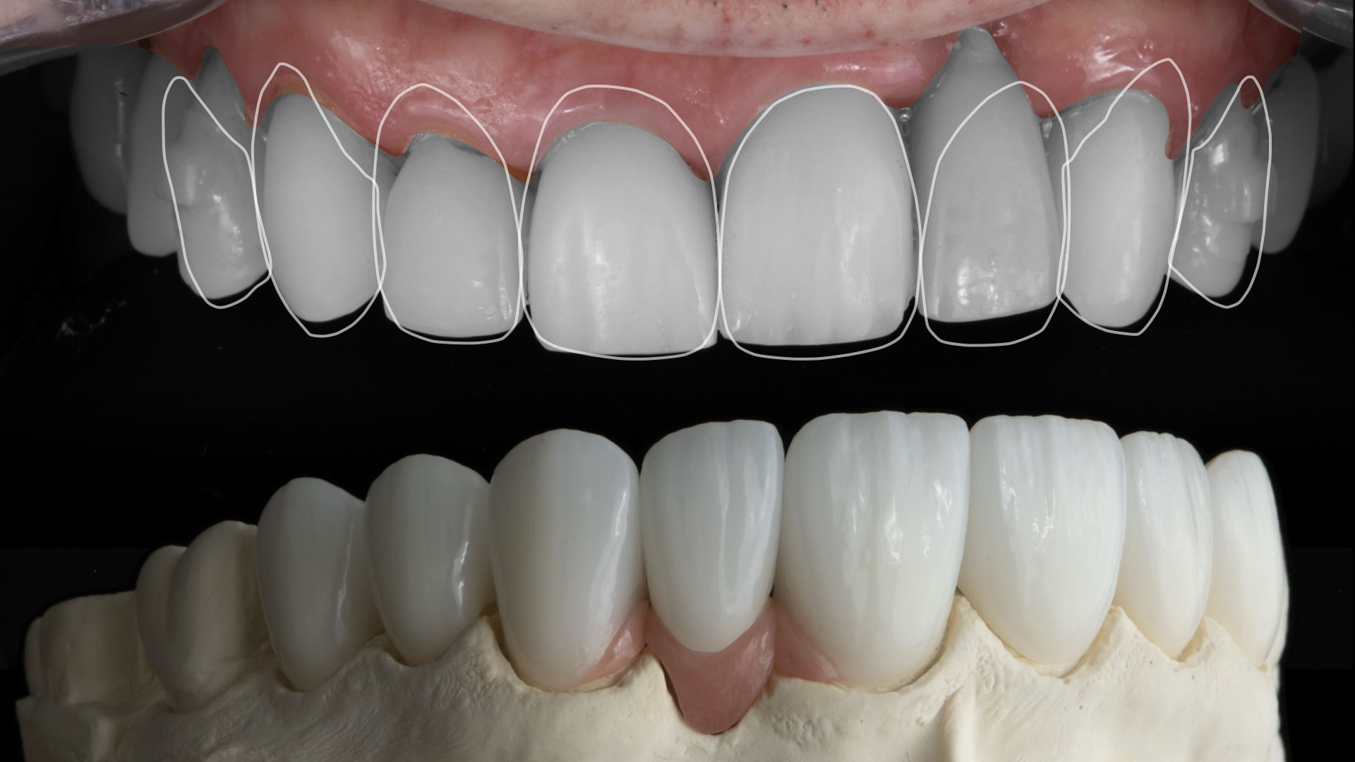 Managing Esthetic Discrepancies