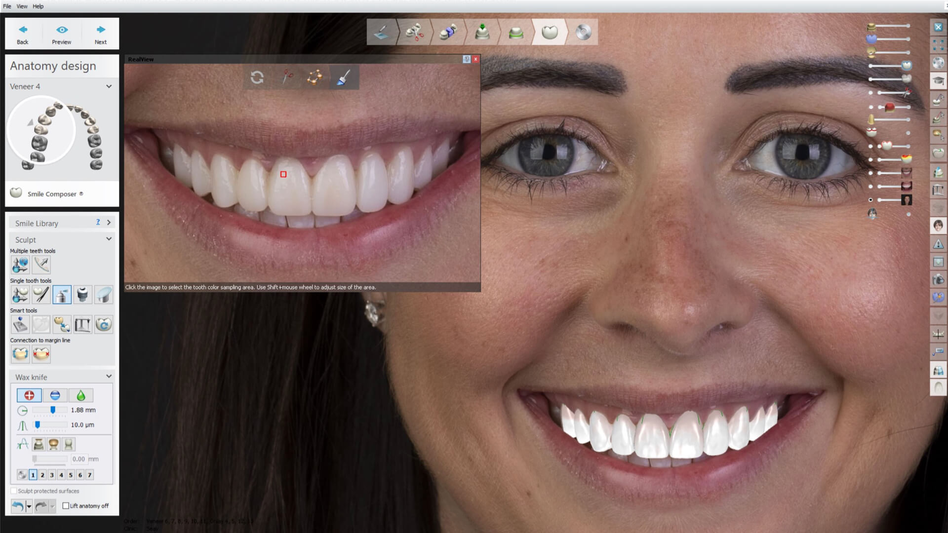 Leveraging Digital Workflows for Harmonizing Teeth and Facial Features