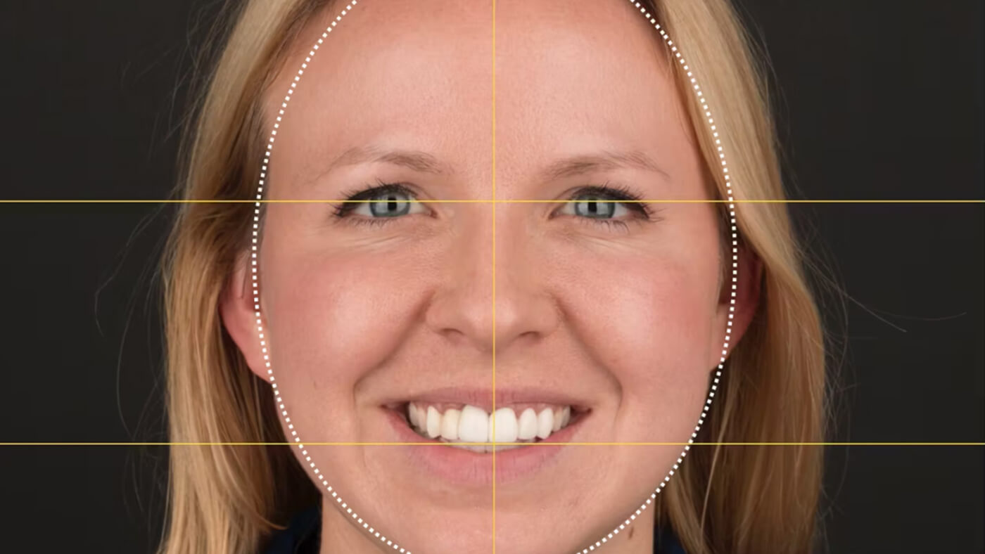 Digital Facebow in Keynote